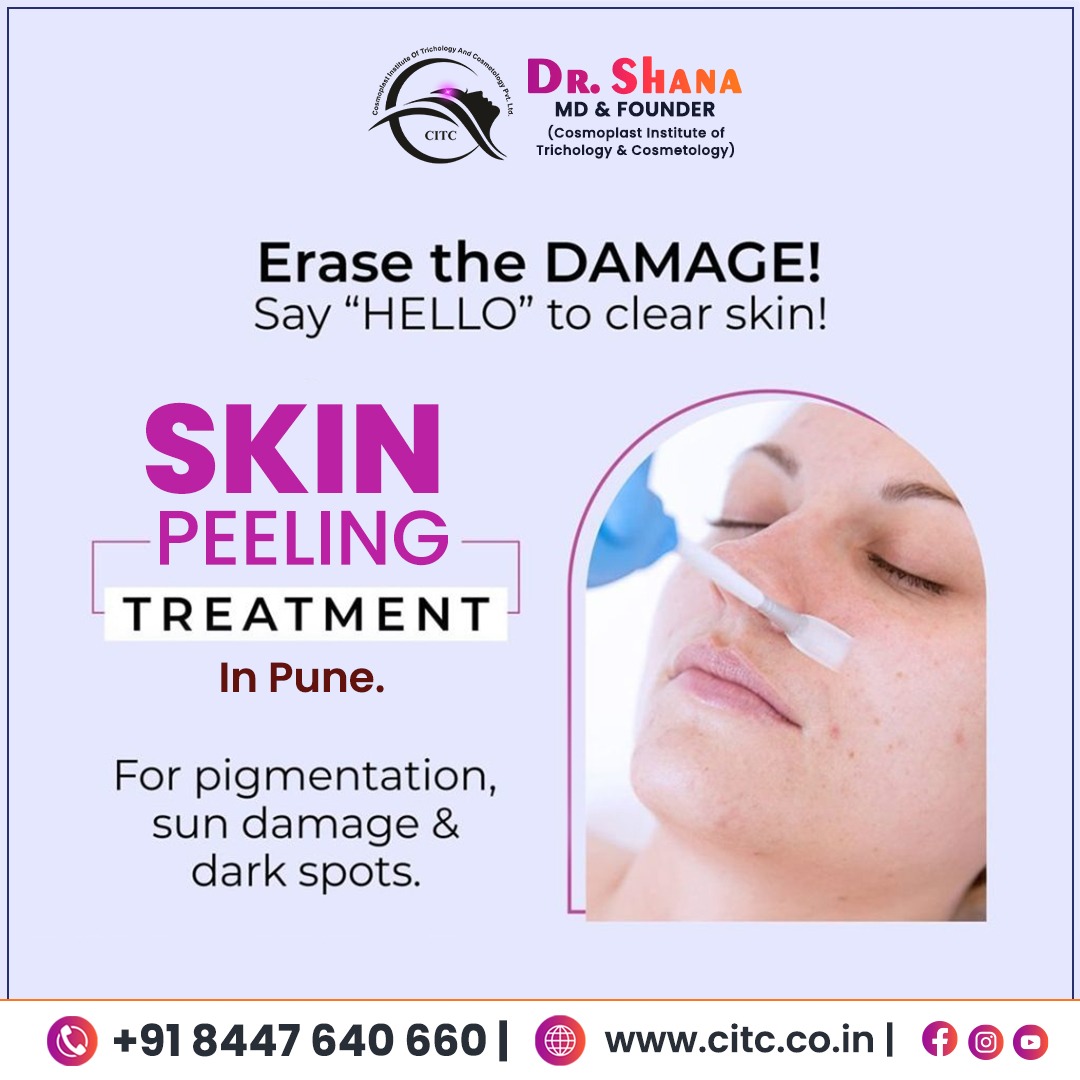 Skin Peeling in Pune