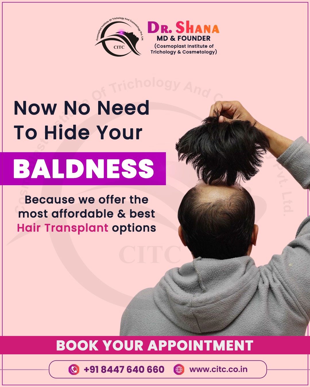 Affordable Hair Transplant in Pune
