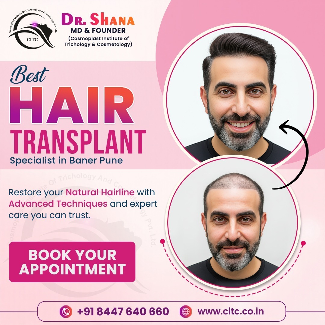 Best Hair Transplant Specialist in Baner Pune